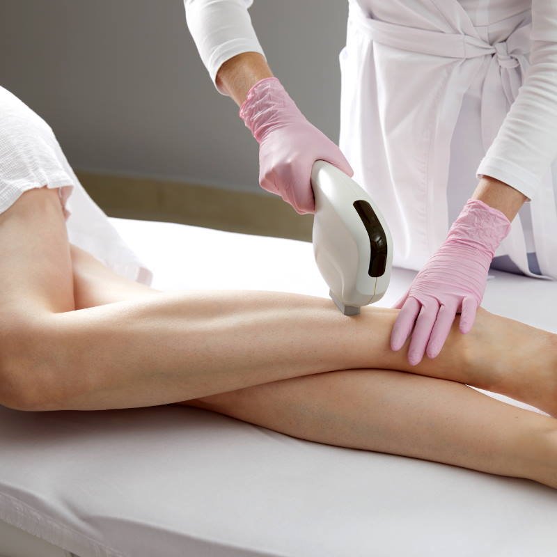  Синхро РЕПЛЕЙ для лазерной эпиляции