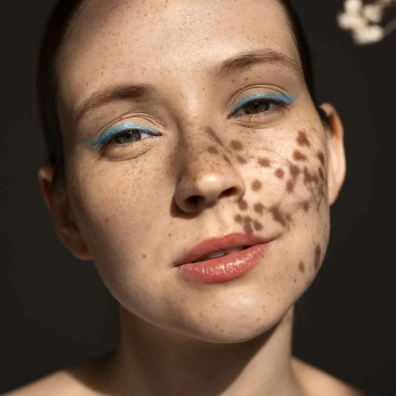 Пигментация