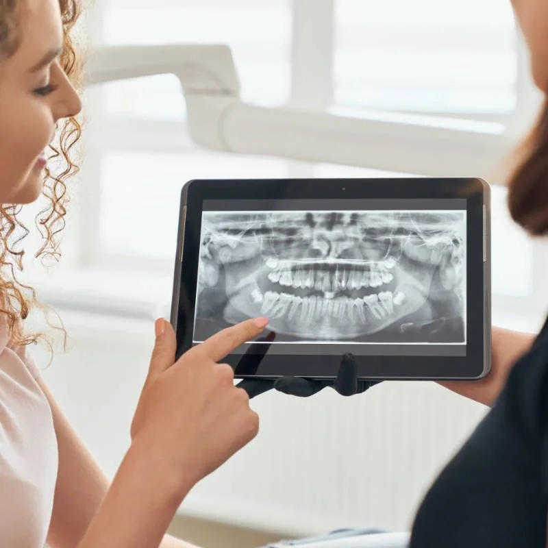 Ортопантомограмма зубов⠀