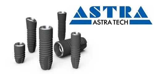 Импланты Astra Tech: цена, приживаемость, плюсы и срок службы