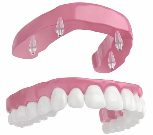 Несъёмное протезирование зубов