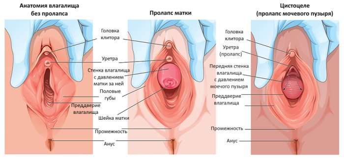 Доброкачественные и злокачественные опухоли половых органов - Адамант Медицинская Клиника