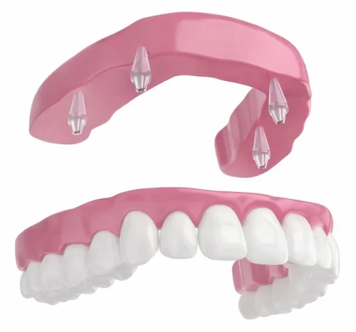 Несъёмное протезирование зубов