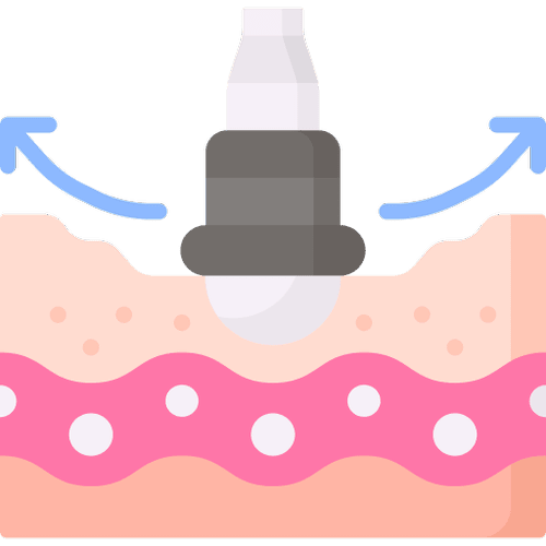 Лечение рубцов