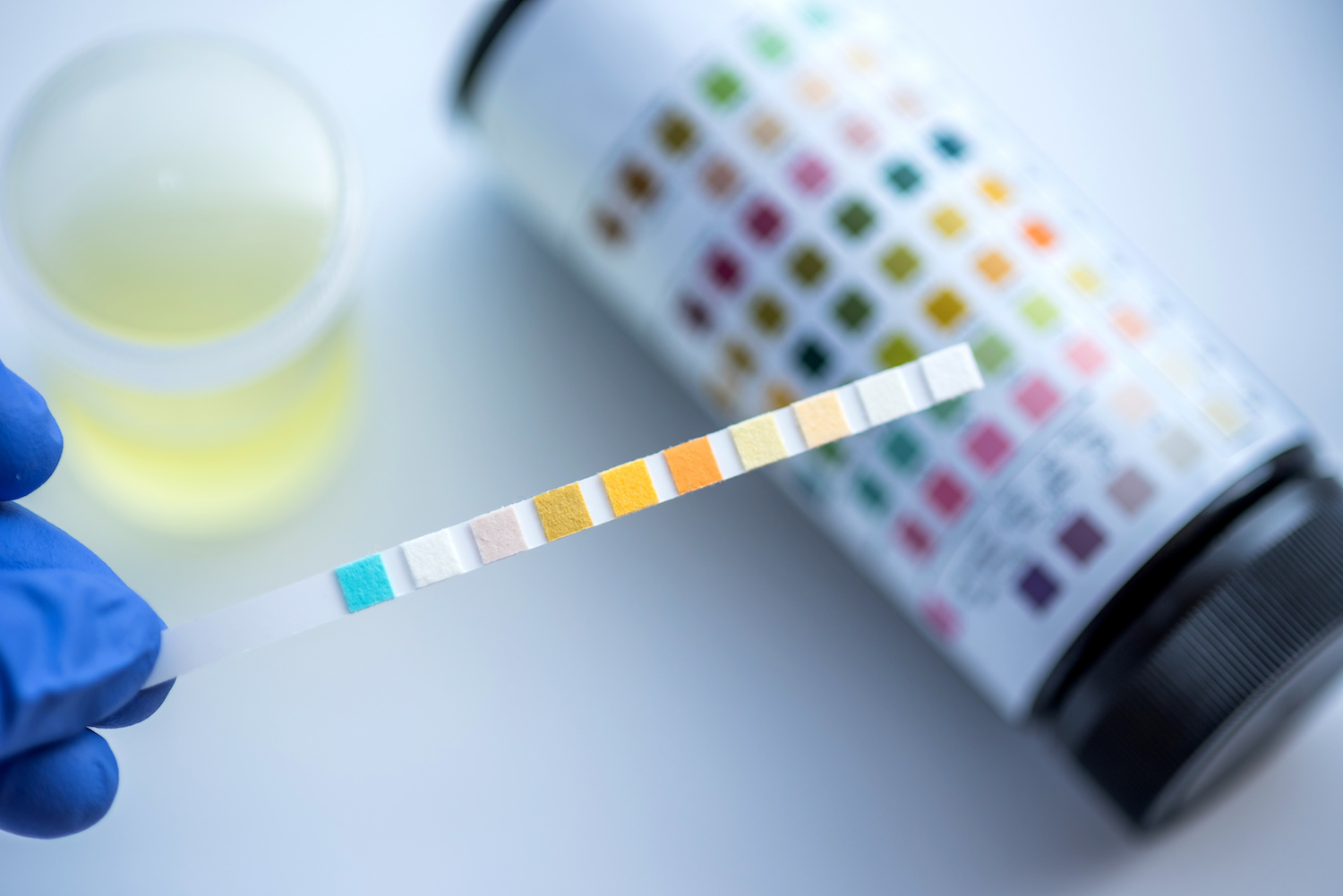 urine-smaller.jpg