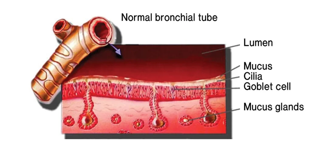 Bronchi After Halotherapy.jpg