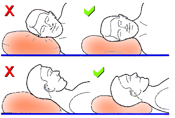 sleeping neck posture