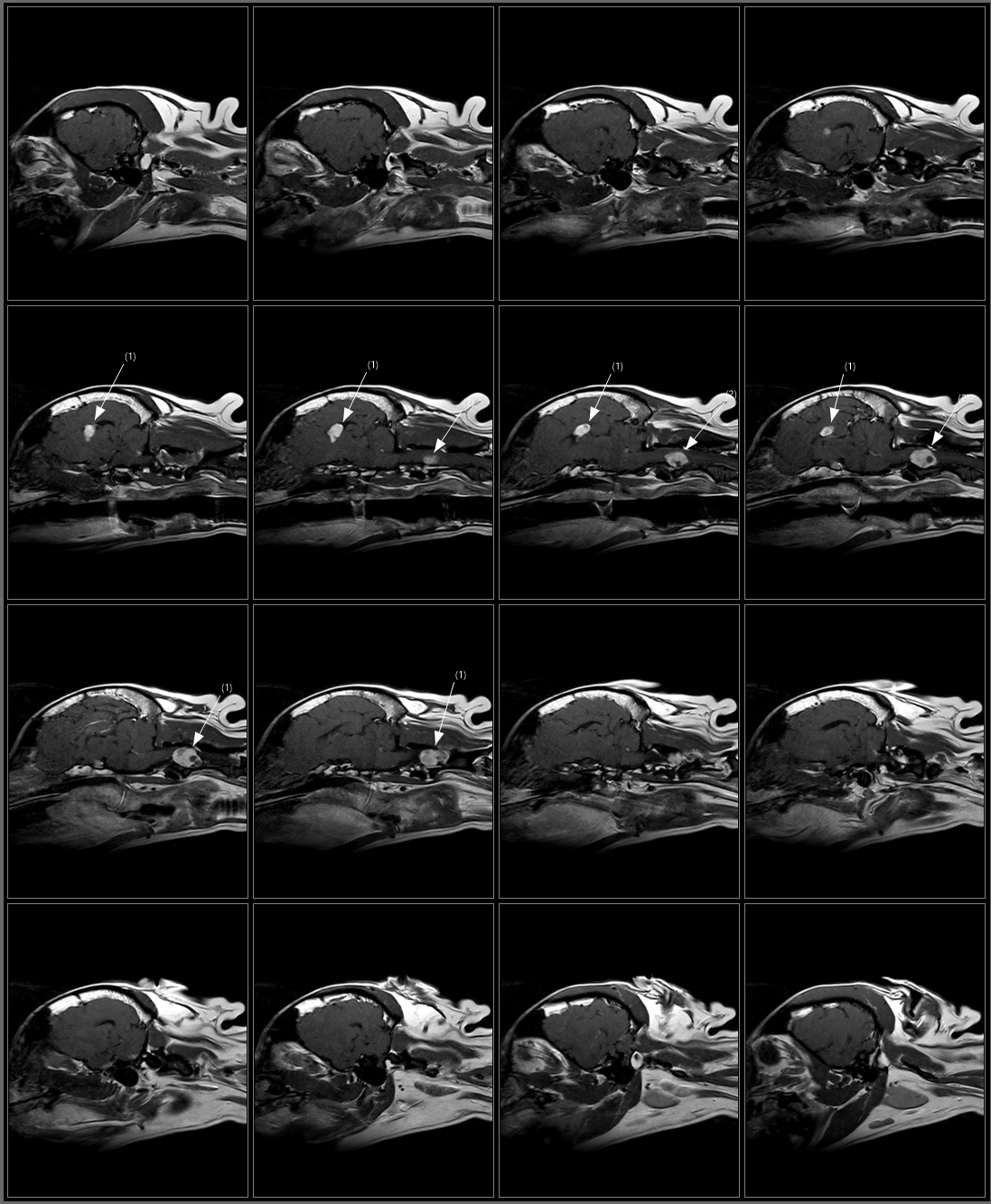 Brain T1 SE Sagittal Post.png