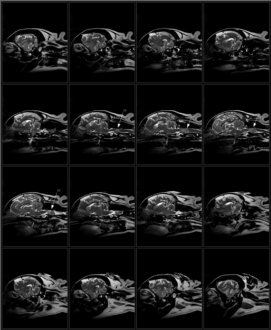 Brain T2 FSE Sagittal.png