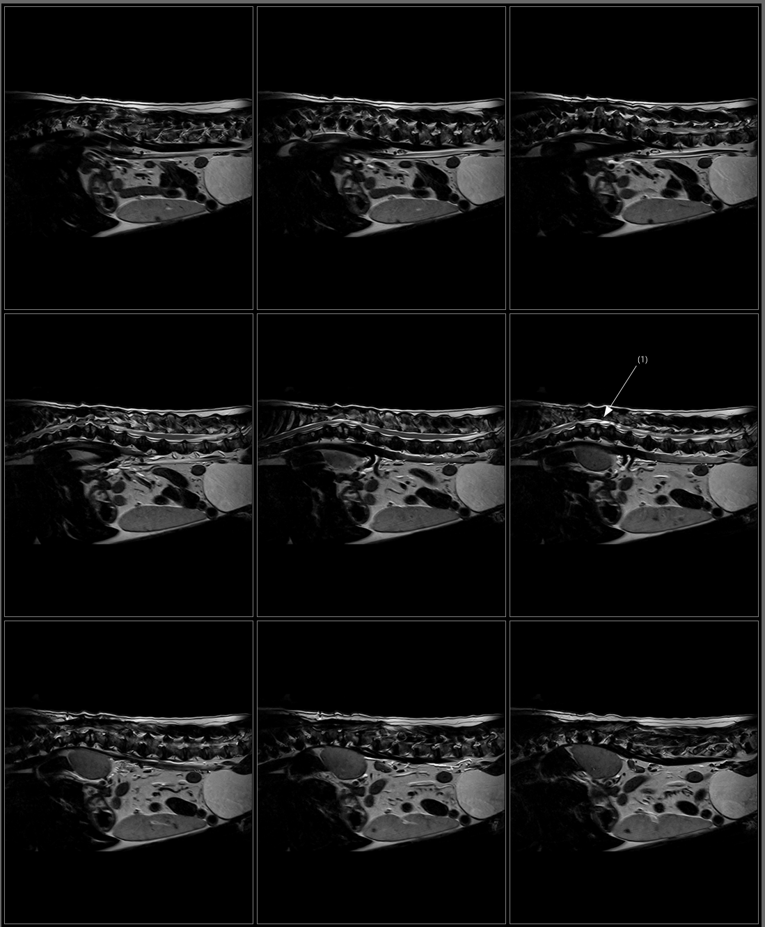 TL Spine T2 FSE Sagittal.png