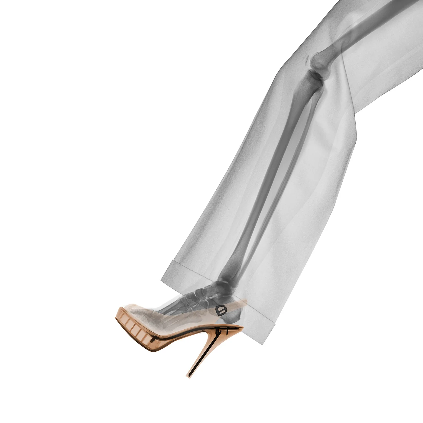 David_Arky_x-ray_leg and high heel.jpg