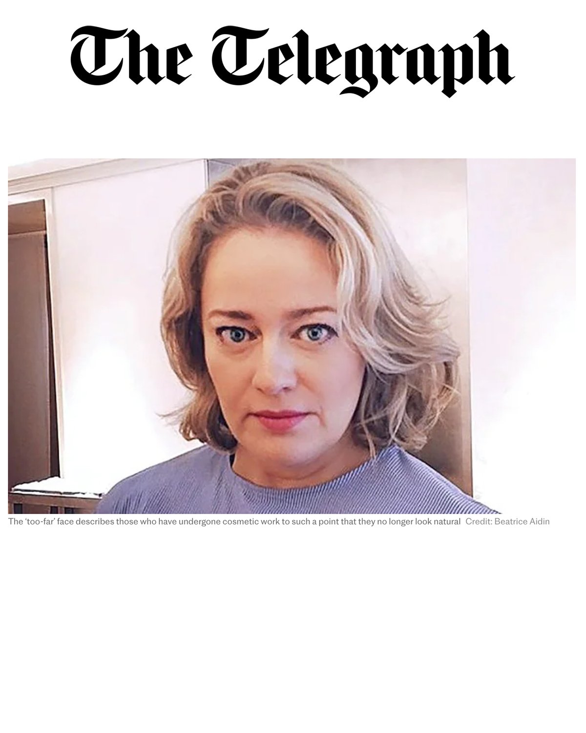 STELLA I had the 'too-far' face 