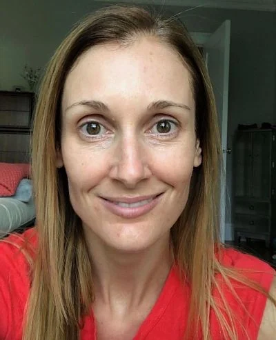One week later, my skin is clearer, pores smaller and fine lines softened.