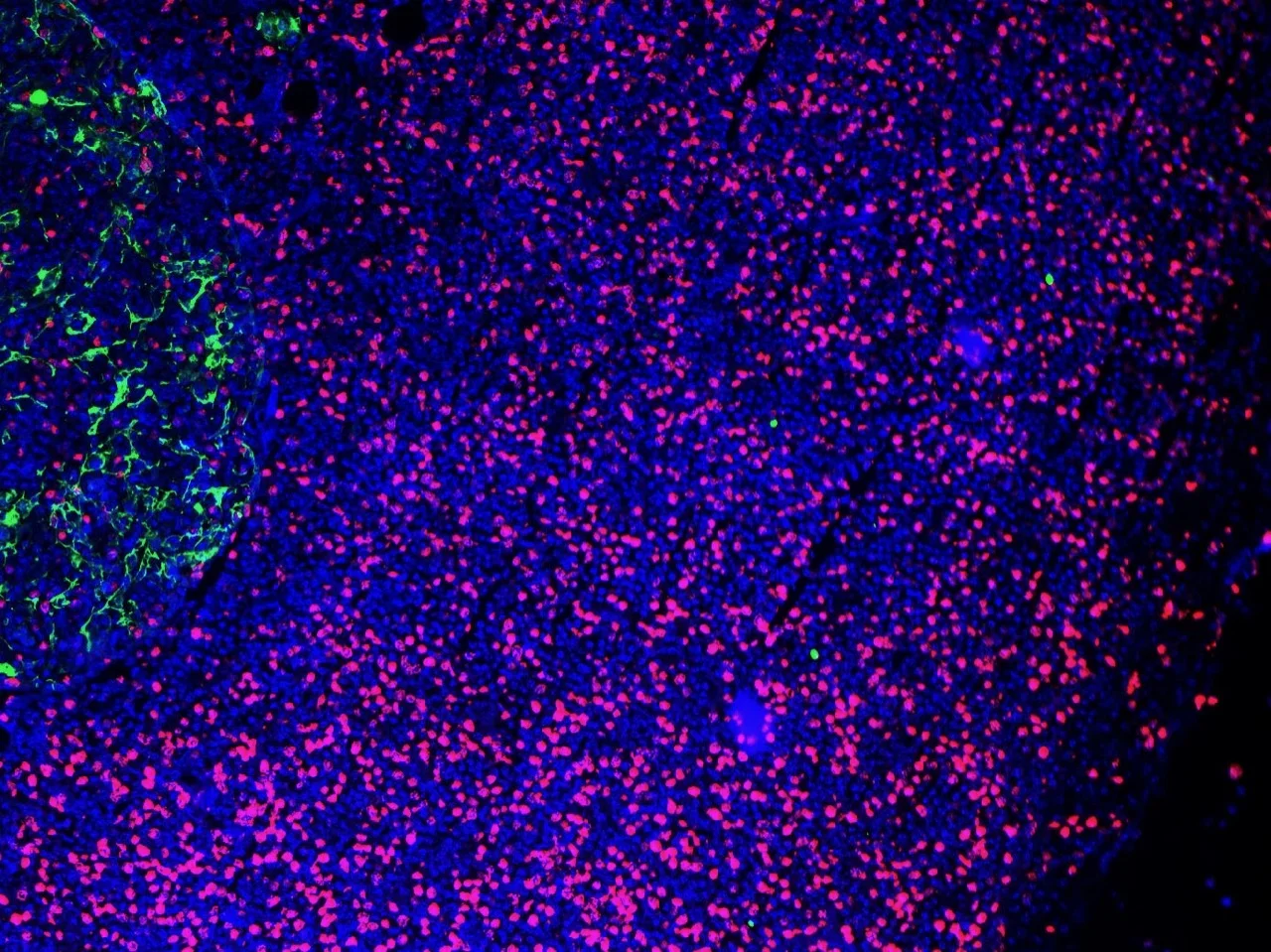 LN3.5DD.M4.Pank(G).CD8(Cyan).BrDu(R).Dapi.10x#2.jpg