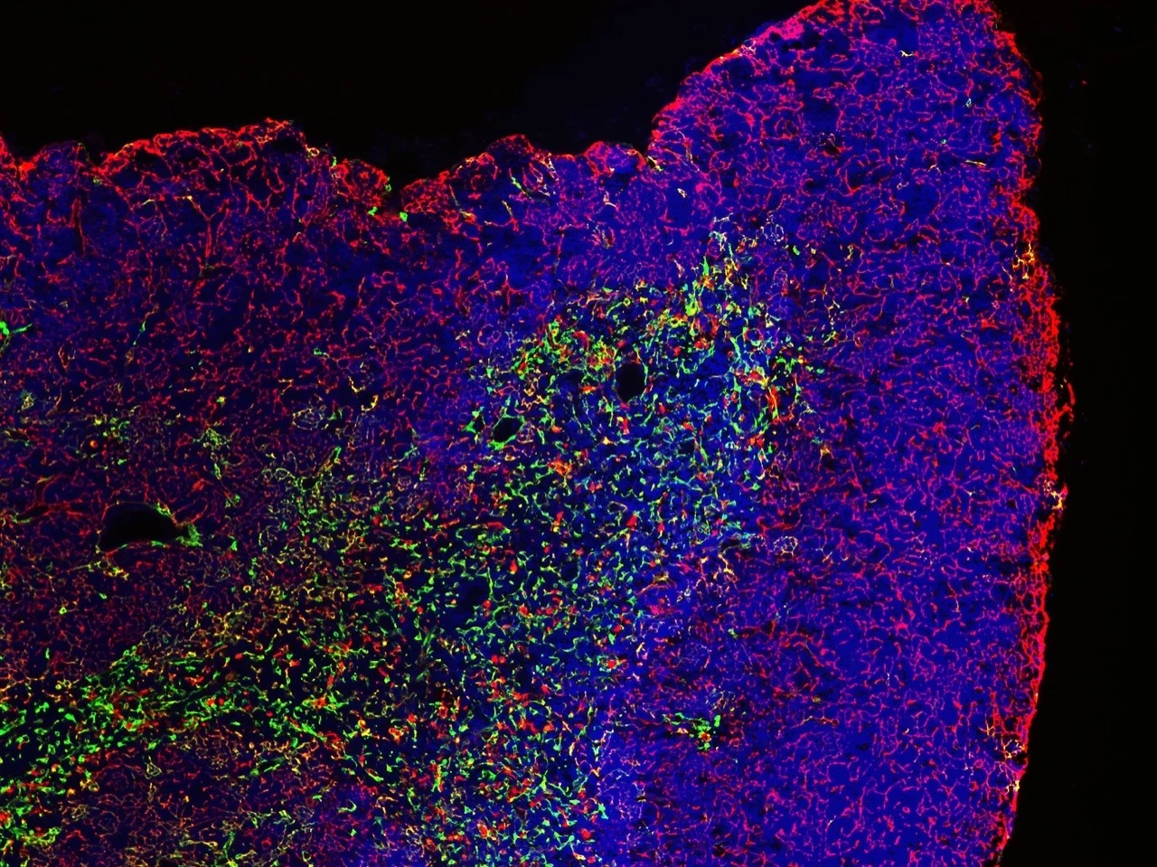 WT.3M.K5(G).K8(R).Dapi.5x#20.overlay.jpg