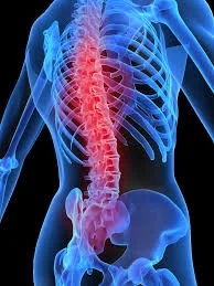 back care.jpg