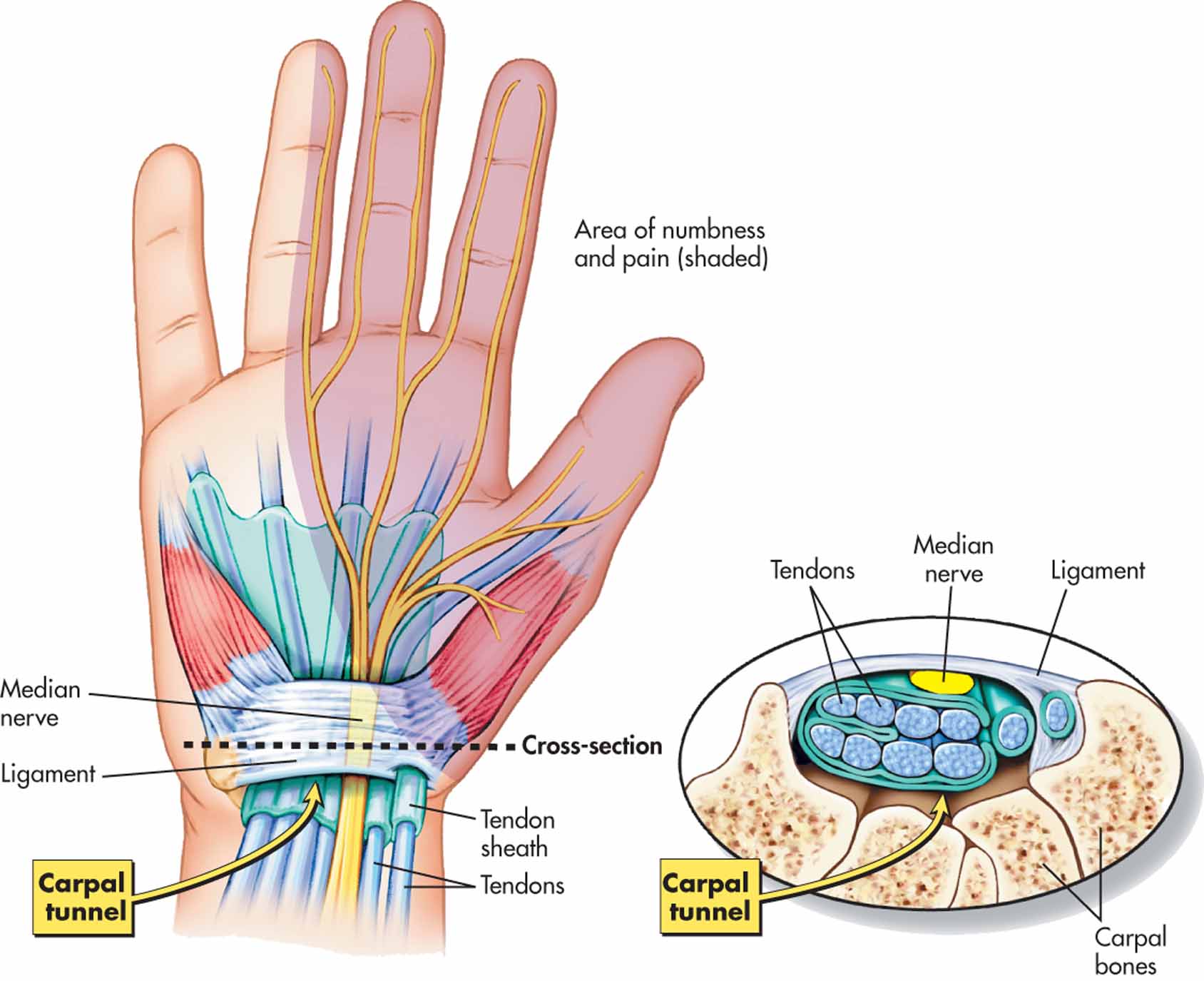 wrist.jpeg