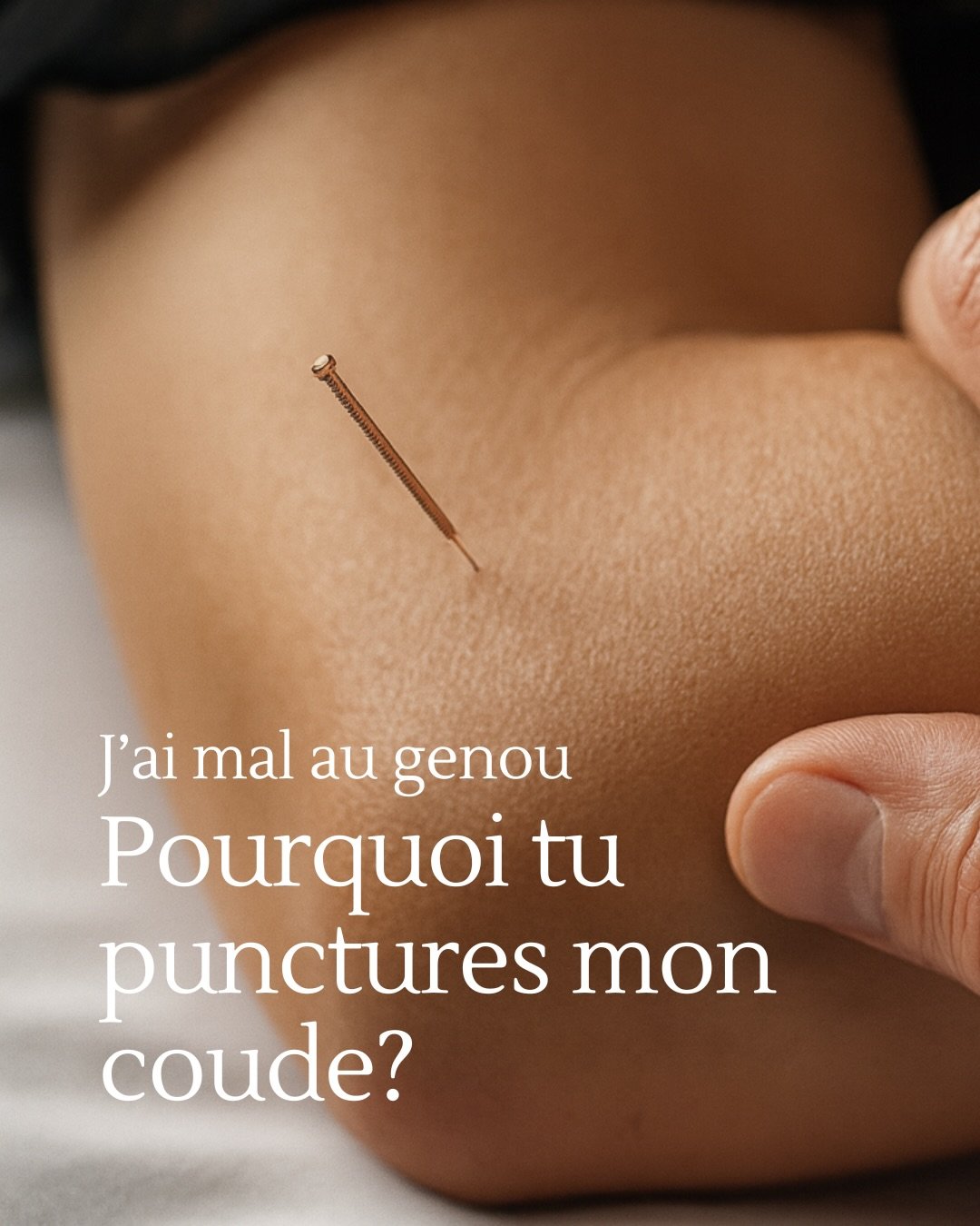 Tu viens pour une douleur &agrave; un endroit pr&eacute;cis et ton acu met ses aiguilles ailleurs? C&rsquo;est souvent le moyen d&rsquo;obtenir de meilleurs r&eacute;sultats.

En acupuncture, on ne se limite pas &agrave; regarder la zone douloureuse,