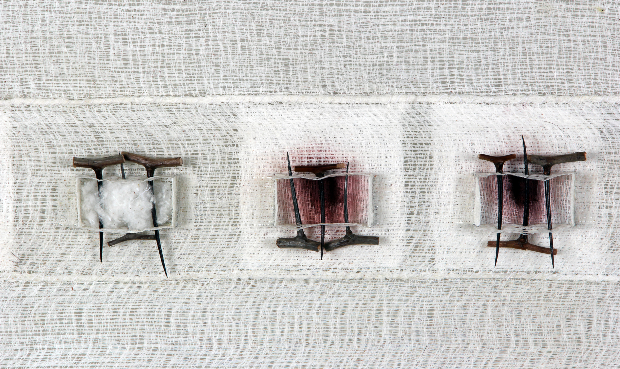 Studies in Pain management II (Detail)