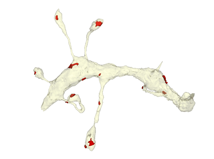 3-Dimensional Dendritic Ultrastructure