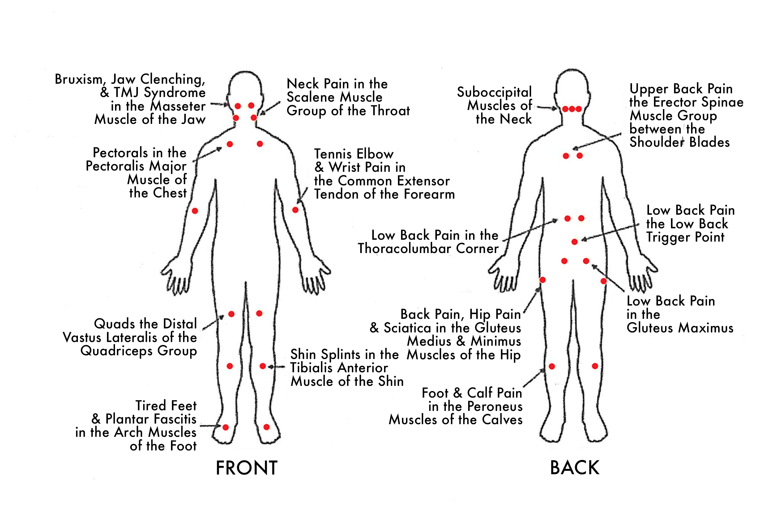 trigger-points_full-page.png