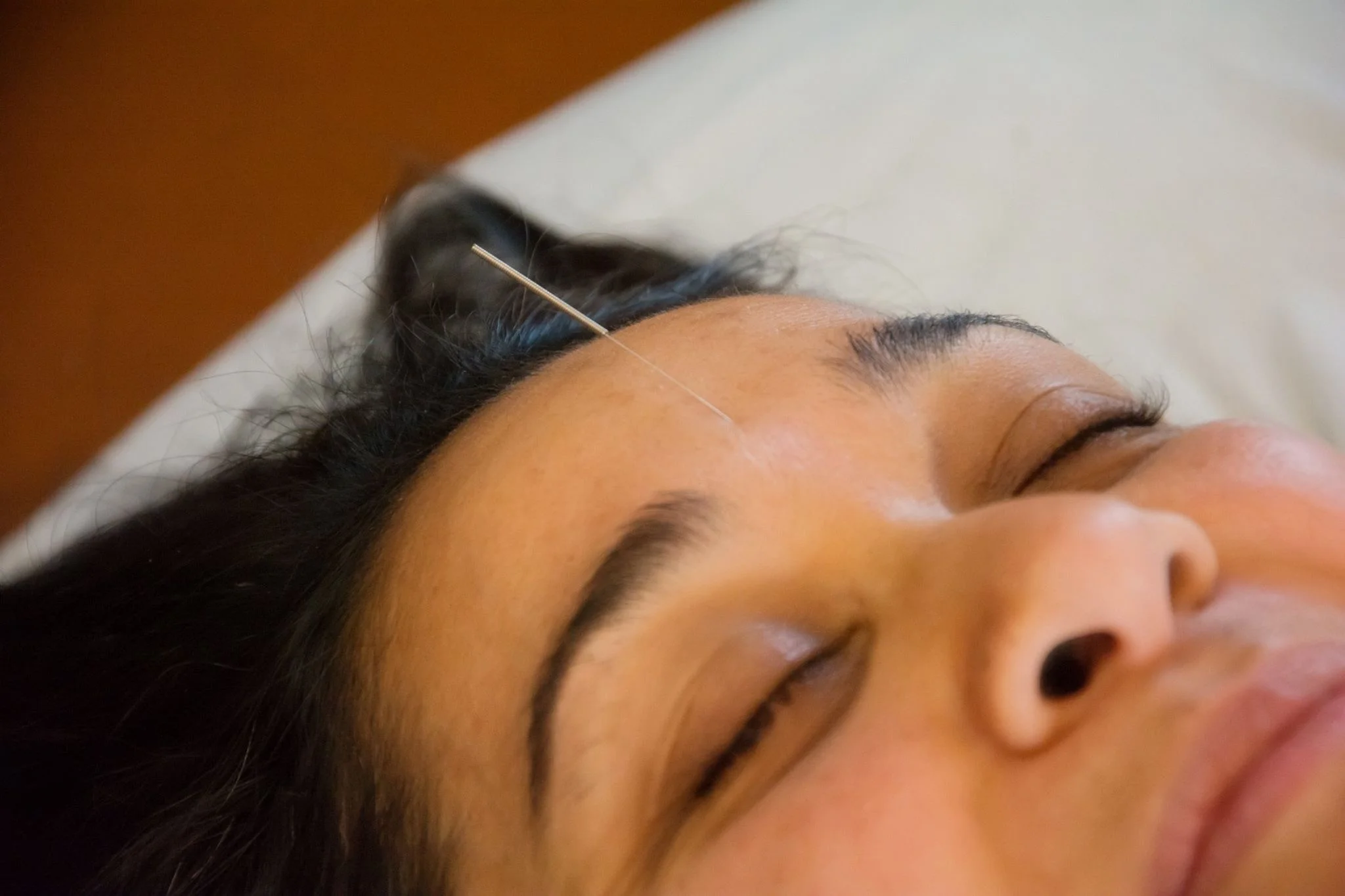 Cosmetic Acupuncture, A Vacation For Your Face!