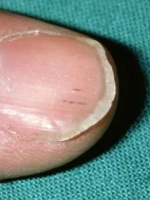 nailphoto.jpg