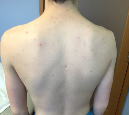 Here are pictures of his skin at the same appointment
