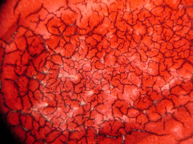 Here is the blood after 6 months.
