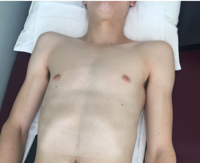 Here is his skin after 6 months