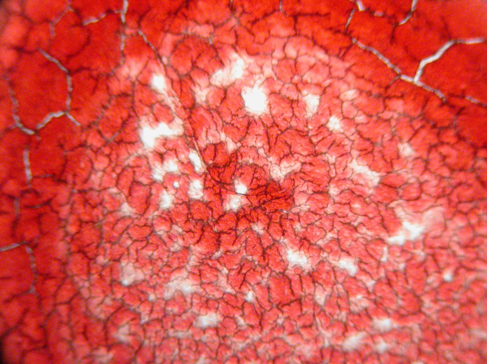 Her healing blood during the course of treatment