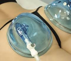 Elva Booty Popper The use of suction cups with negative pressure to mobilize fat cells to a more desirable area, giving the area a fuller, rounder look. Booty Plumping can be done to either the hips or the bum. - Reduces Cellulite - Slims The Waist - Tones Thighs - Tones Tummy - Reduces Stretch Marks & More Elva Booty Package 60 mins | $90 | 3 for $250 90 mins | $130 | 3 for $360 Booty Plumping Wooden Sculpt Cavitation Lipo Slim Thick Package (Waist & Booty) 60 mins | $120 | 3 for $320 90 mins | $160 | 3 for $450 Cavitation Lipo Laser Lipo Vacuum Therapy Booty Plumping RF Skin Tightening Wood Sculpting *Wood Sculpting x2 *Cavitation Lipo x2