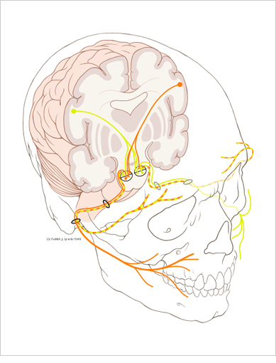 Bell Palsy.png