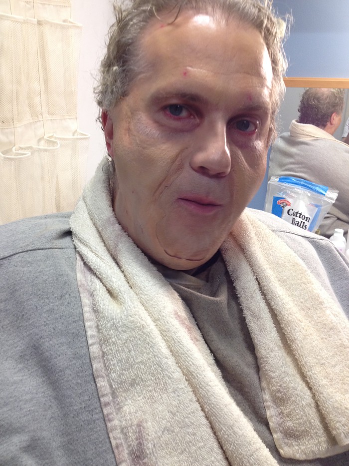 The Whale, Charlie Overweight/Sickly Makeup Application Latex Prosthetics (Later Cut)
