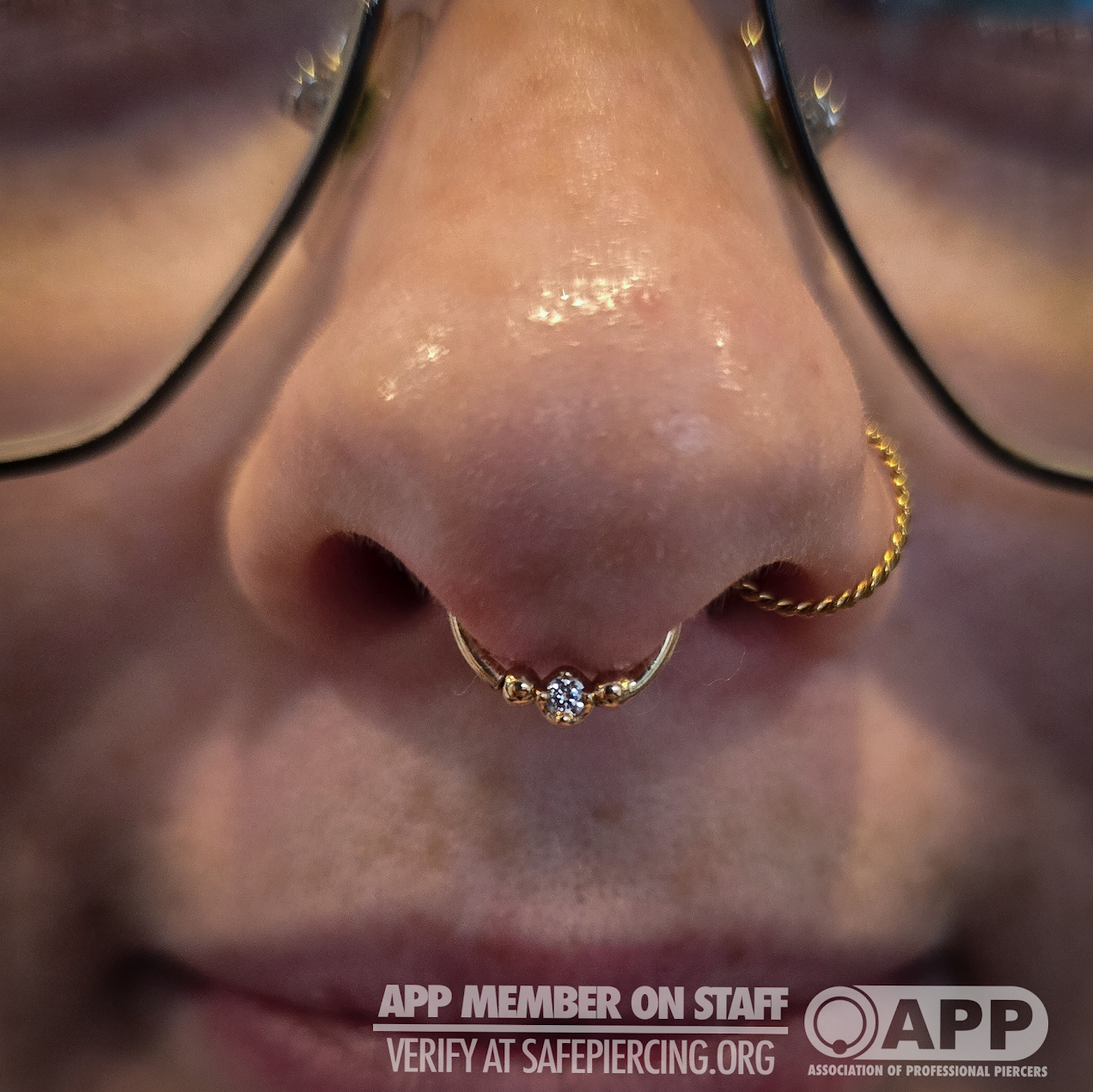Septum.png
