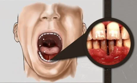 A Great Canadian Resource on Smokeless/Chewing Tobacco