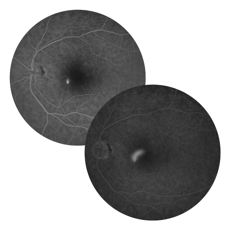 Refer a Patient — THE RETINA INSTITUTE