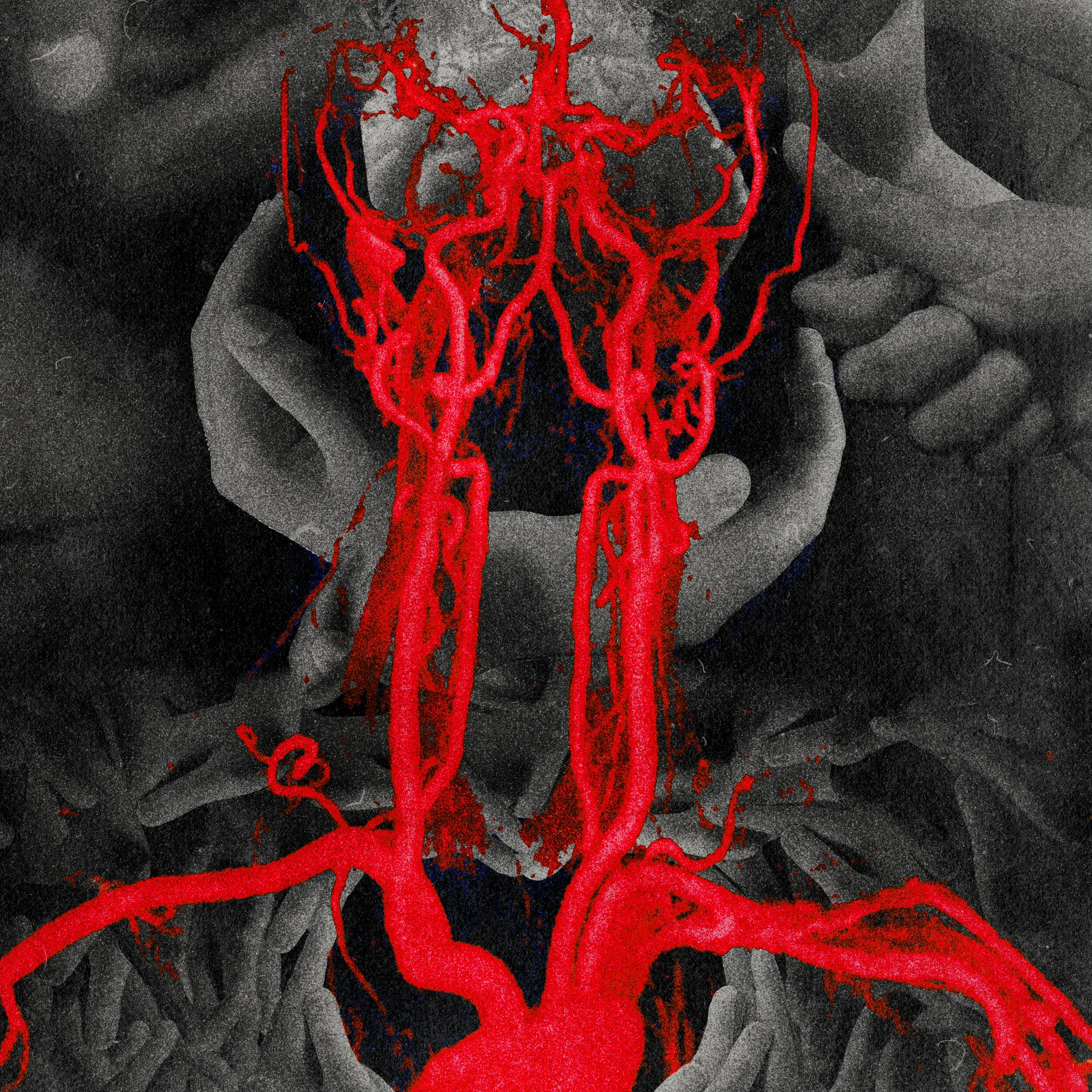 Narcissistic-Mortification-NarcMort