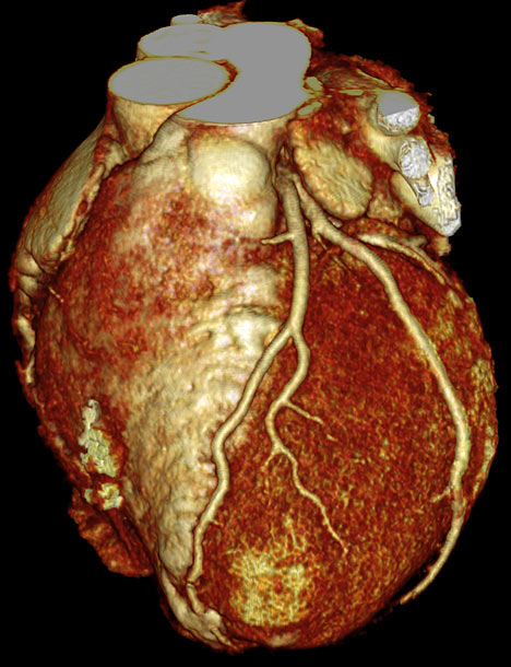 CTA-Healthy Heart.jpg