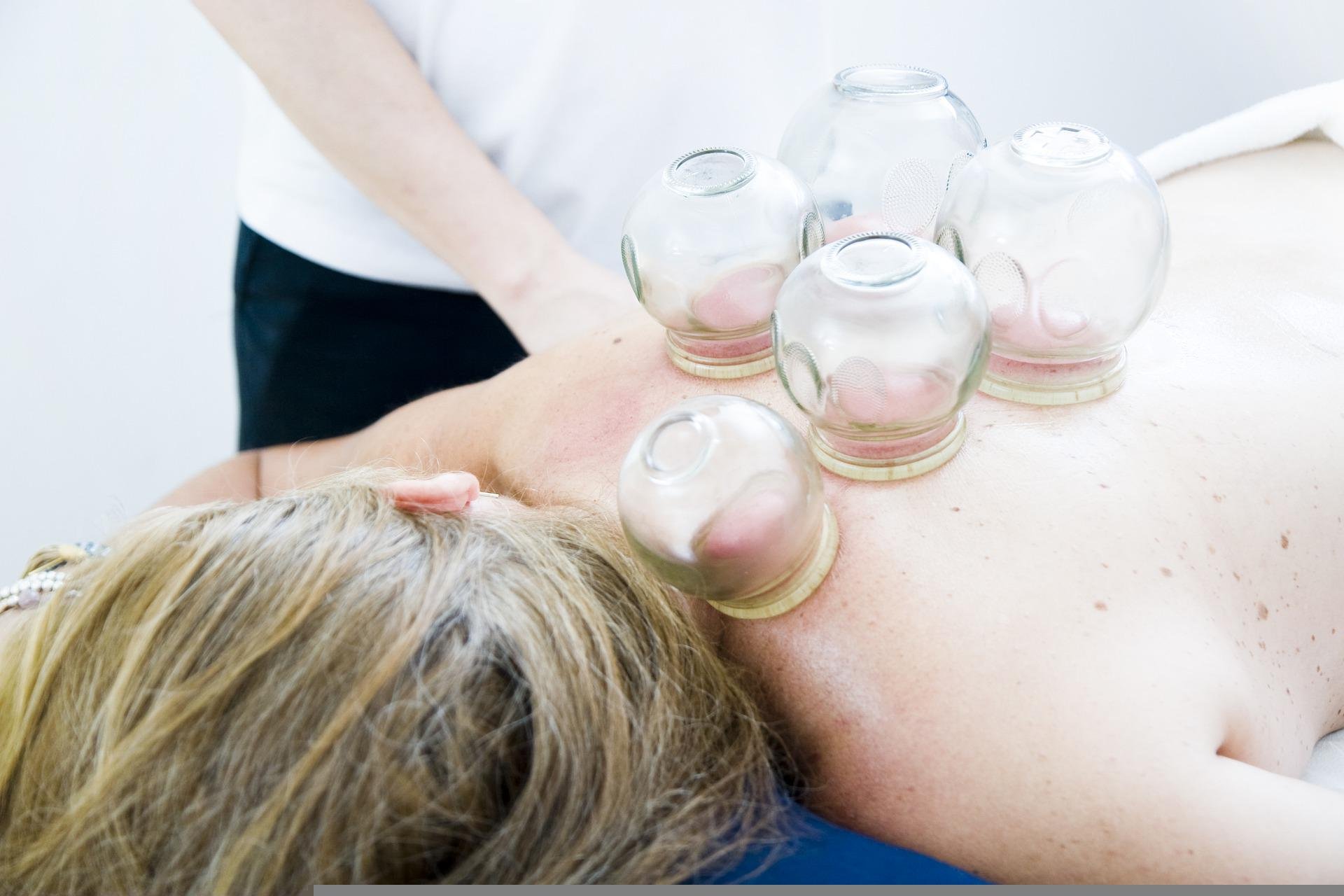 cupping-therapy-gadca5862f_1920.jpg