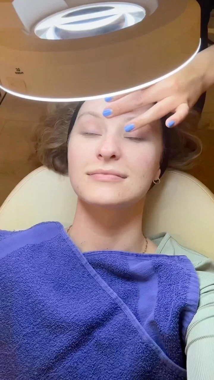 How to do extractions at home — Clean Your Dirty Face