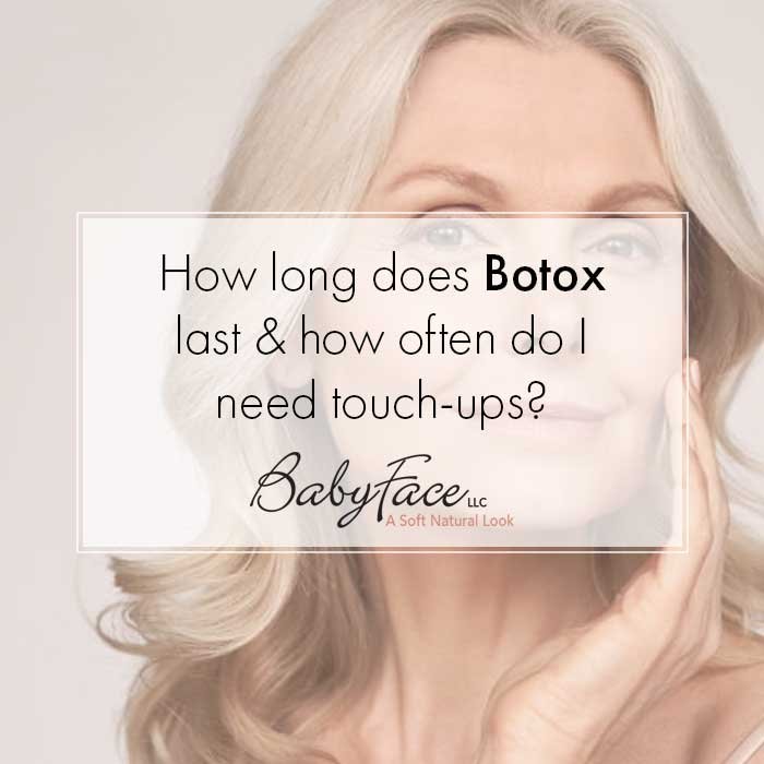 Learn how long Botox lasts & when to touch up - BabyFace MedSpa AZ — Top  Rated Scottsdale Med Spa