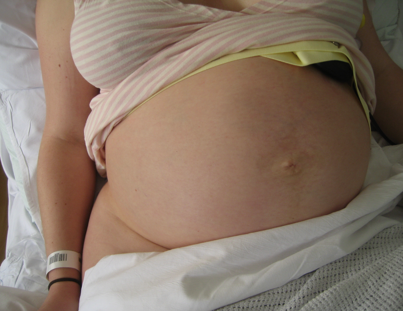 A doula's guide to induction