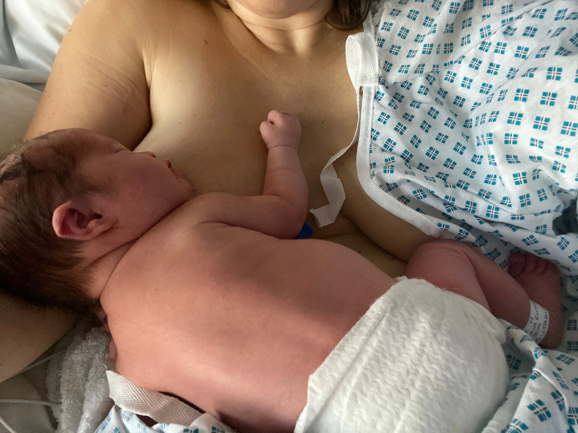 Your first 24 hours after a caesarean birth