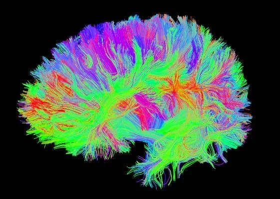 Brain.jpg