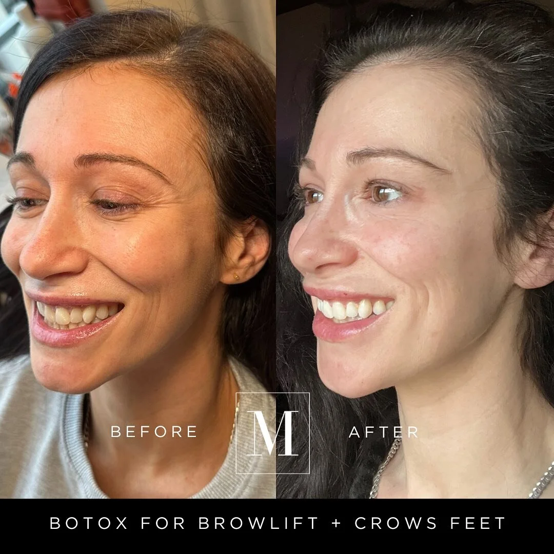 Pricing | Monaco Rejuvenation — Monaco Medical Aesthetics