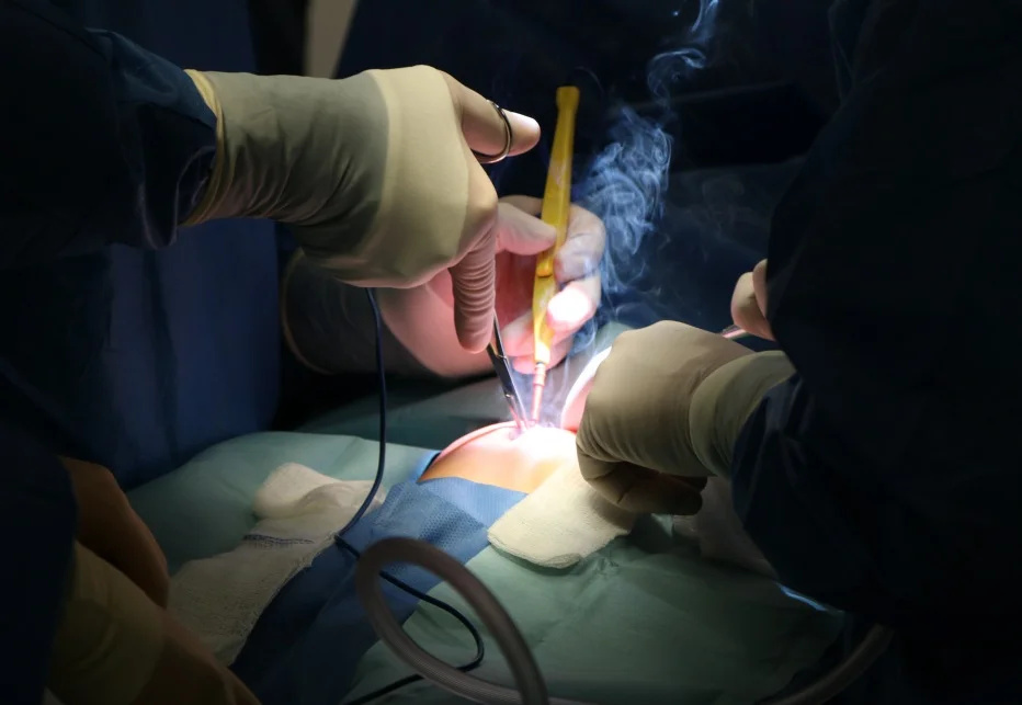 GIFT OF LIFE While the lead surgeon makes a chest incision, assistants cauterize the wound to minimize blood loss. During this mission, surgeons Raff and Serrano worked together in the operating room for the first time–saving the lives of five Mexican children.