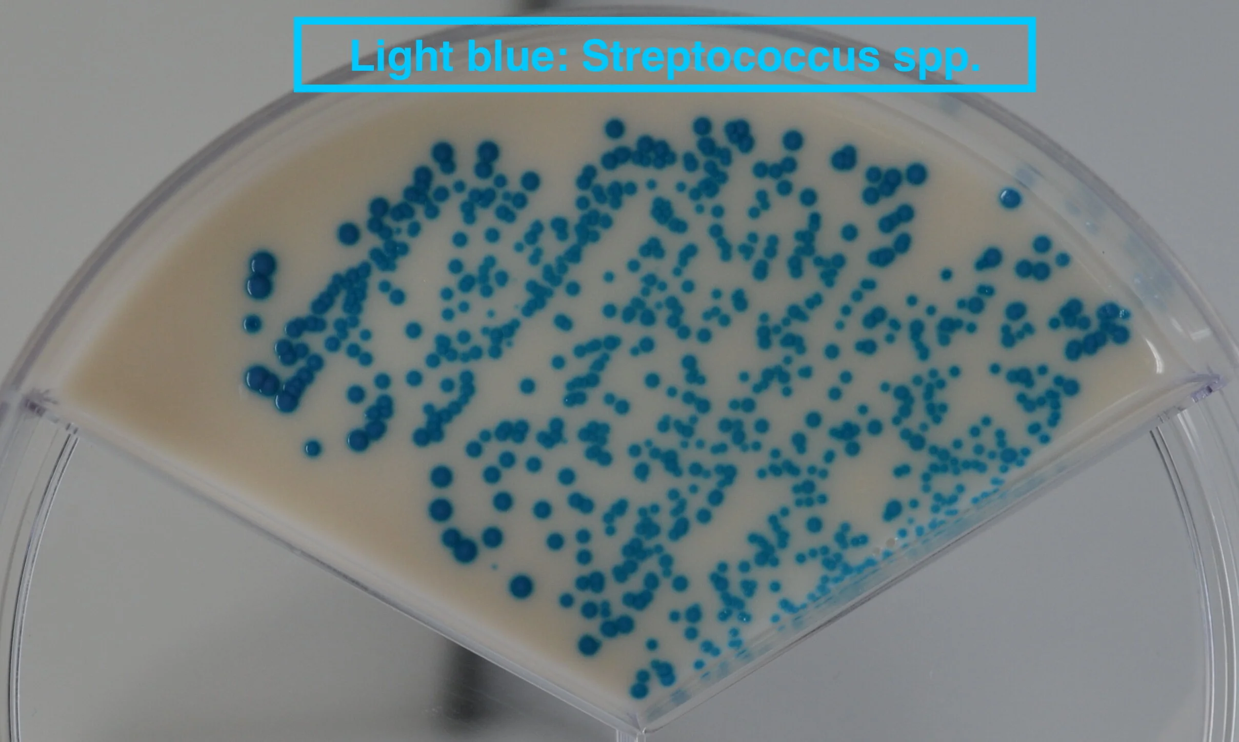Streptococcus spp..JPG