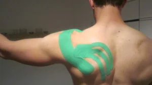 Kinesio-taping application for shoulder support