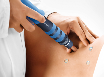 Shockwave therapy low back pain